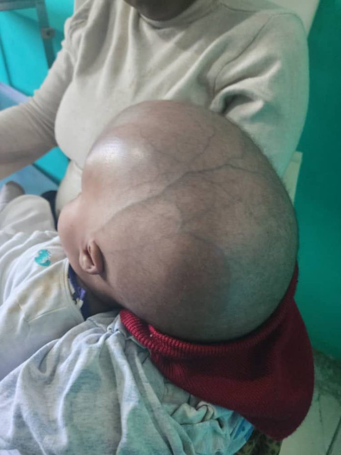 Fundación Cruz Jiminián y el Hospital El Buen Samaritano de La Romana iniciaron formalmente la Octava Jornada de Cirugías de Hidrocefalia